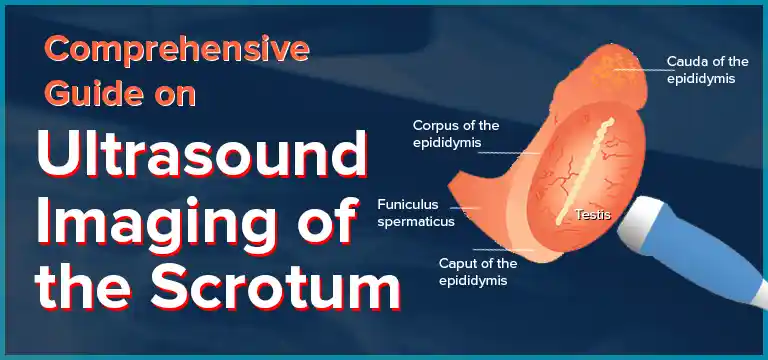 Comprehensive Guide on Ultrasound Imaging of the Scrotum